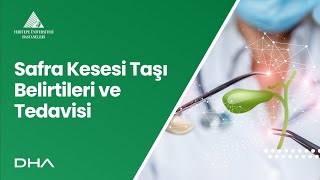 Safra Kesesi Taşı Belirtileri ve Tedavisi  Doç Dr Kinyas Kartal [upl. by Alur]