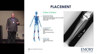 Intraosseous Access  David Carpenter MPAS PAC [upl. by Leumhs]