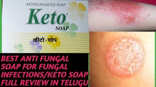 BEST SOAP FOR FUNGAL INFECTIONS AND ITCHENG AND SKIN RASHESKETO SOAP FULL REVIEW IN TELUGU [upl. by Eoin]