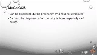 Cleft Lip and Cleft Palate [upl. by Namia]