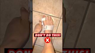 Bunion pain relief bunion bunions [upl. by Therine]