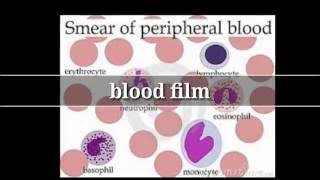 Blood film تحليل [upl. by Rafaelof762]