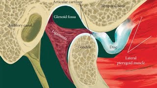 TMJ disc displacement with reduction and without reduction the differenceعربي [upl. by Gnah]