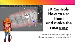 Invisalign ClinCheck Modifications with 3D Controls [upl. by Rettig]