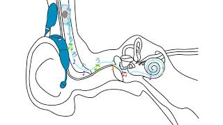 人工内耳 聞こえの仕組み（アドバンスト・バイオニクス） [upl. by Alderson]