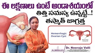 Causes amp Treatment for Hemorrhagic Cyst  Dr Neerajas Fertility amp Gynaec Center [upl. by Dearr]