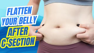 How to Reduce Belly Fat After CSection [upl. by Suzetta953]