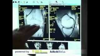 Zentrum für Orthopädie amp Traumatologie Dr med E Merkle [upl. by Ydnak]