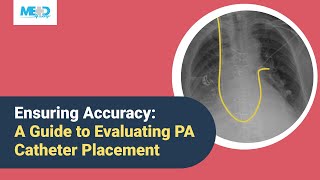 Ensuring Accuracy A Guide to Evaluating PA Catheter Placement [upl. by Learsi]