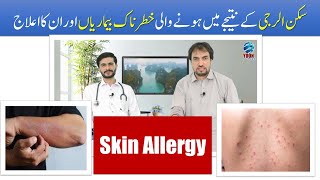 Skin Allergy Treatment  سکن الرجی علاج  Dr Seyaf Khan Sifat  Health Care with Saqib Afridai [upl. by Ayekram]