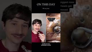 “World’s Biggest Blackheads” dermreacts pimplepopping [upl. by Watt]