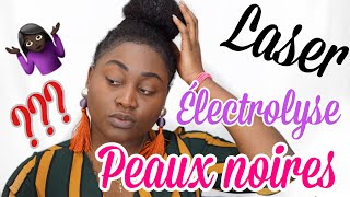 Epilation définitive du visage la méthode la plus efficace  Revue complète sur lélectrolyse [upl. by Nolubez371]