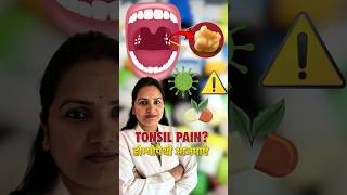 Tonsil stones Treatment  Tonsillitis medicine in homeopathy [upl. by Cleveland]