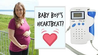 Strong Heartbeat On Fetal Doppler  20 Weeks [upl. by Sabrina]