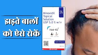 hair 4 u  Hair 4u f solution  Minoxidil hair regrowth results hair 4u minoxidil 5 review [upl. by Eerrehc368]