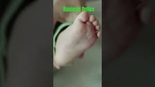 quotNewborn Babys Babinski Reflex Fascinating Developmental MilestonequotNewbornBabinskiReflex newborn [upl. by Simmonds187]