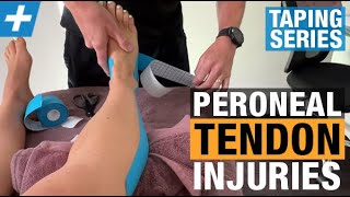 How to Tape for Peroneal Tendon Injuries [upl. by Ardek]