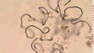 Protozoa feeding on a decaying colony of Anabaena cyanobacteria [upl. by Nagard]