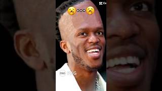 Ksi forehead [upl. by Bertasi360]