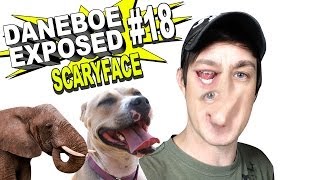 Daneboe Exposed 18 SCARYFACE [upl. by Ainatnas]