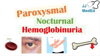 Paroxysmal Nocturnal Hemoglobinuria PNH  Causes amp Pathogenesis Symptoms Diagnosis amp Treatment [upl. by Llednek]