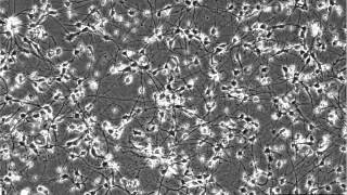 28 Day Timelapse of Plated iCell® Neurons [upl. by Ewell]