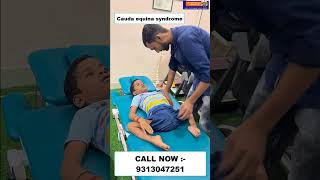 Cauda equina syndrome  Chiropractic Treatment in Mumbai  Dr Varun  Call  9313047251 mumbai [upl. by Neelrahc529]