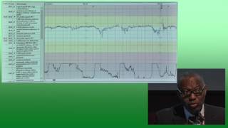 Discussione casi clinicipatterns cardiotocografici  G Maso A Ugwumadu [upl. by Cogswell663]