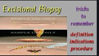 Types of biopsyExcisional biopsypart 3 [upl. by Meuse776]