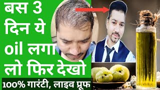 Best Hair Growth Herbal Oil For Male Female  Baal Ugane Ki Dawa  How To Regrow Hair [upl. by Elehcir]