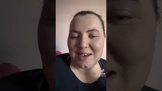 The Journey to My Upper Denture shortsyoutube shortsviral denturegang denture [upl. by Renaxela]