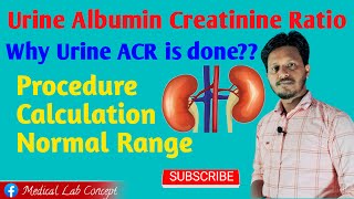 Urine ACR Principle amp Procedure with Calculation Labology [upl. by Middleton290]