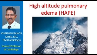 High altitude pulmonary edema HAPE [upl. by Romina]