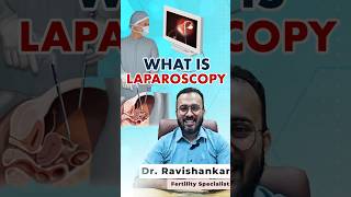 Laparoscopy എന്തിന് ചെയ്യുന്നതാണ് ഗുണങ്ങൾ എന്താണ് [upl. by Kachine]