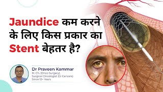 Best Stent for Bile Duct CancerRelated Jaundice  Metal or Plastic Stent  Dr Praveen Kammar [upl. by Einalem]