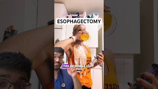 DOCTOR REACTS to ESOPHAGECTOMY and ESOPHAGOSTOMY [upl. by Tudor]