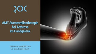 AMT Stammzellentherapie bei Arthrose im Handgelenk  ROC Aschheim [upl. by Corissa]