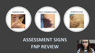 NP Board Review McBurney Cullens Psoas Lachman Homans Obturators McMurray Tinels sign [upl. by Nyladnek]