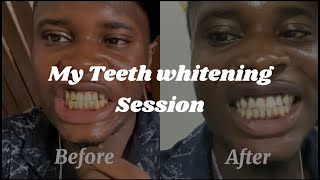 Got My Teeth Whitened to Level Up My Game 😎  Man’s Guide to First Impressions [upl. by Eeuqram]