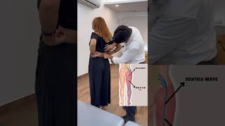 Sciatica pain chiropractic treatment shortfeed feed drharishgrover [upl. by Estevan]