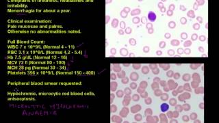 Anaemia in a young woman  Haematology case studies [upl. by Adnek]