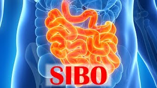 Small Intestinal Bacterial Overgrowth SIBO [upl. by Japeth]