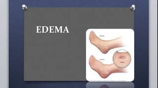 EDEMA  Robbins [upl. by Einaj]