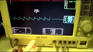 Invivo M12 Anesthesia Monitor [upl. by Kcirttap697]