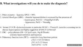 Obesity hypoventilation syndrome [upl. by Goran]