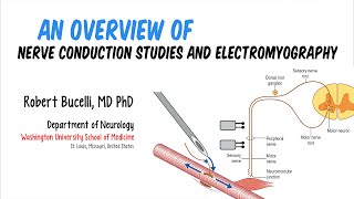 An Overview of Nerve Conduction Studies and Electromyography Feat Dr Bucelli [upl. by Hoisch]