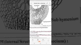 Practical Peziza Apothecium And Puccinia Vinita Singhal [upl. by Zane]