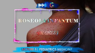 ROSEOLA INFANTUM  DrAREEJ  LECTURE 5 [upl. by Nandor]