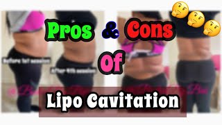 Lipo Cavitation  Laser Lipo  Pros amp Cons  Ep 4 [upl. by Aneertak]