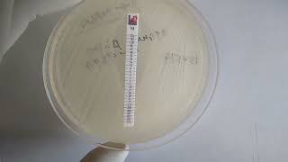 MIC of Vancomycin Determination for Staphylococcus aureus using Epsilometer I E Test Strip [upl. by Aires263]